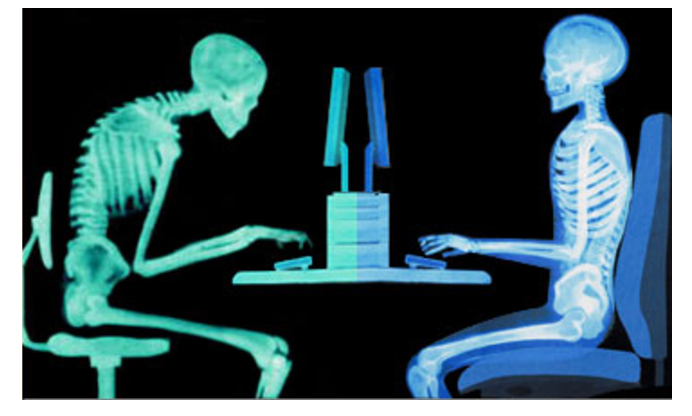 மனித முதுகெலும்புகளின் மோசமான வளைவுகள்!! 6 மனித முதுகெலும்புகளின் மோசமான வளைவுகள்!!